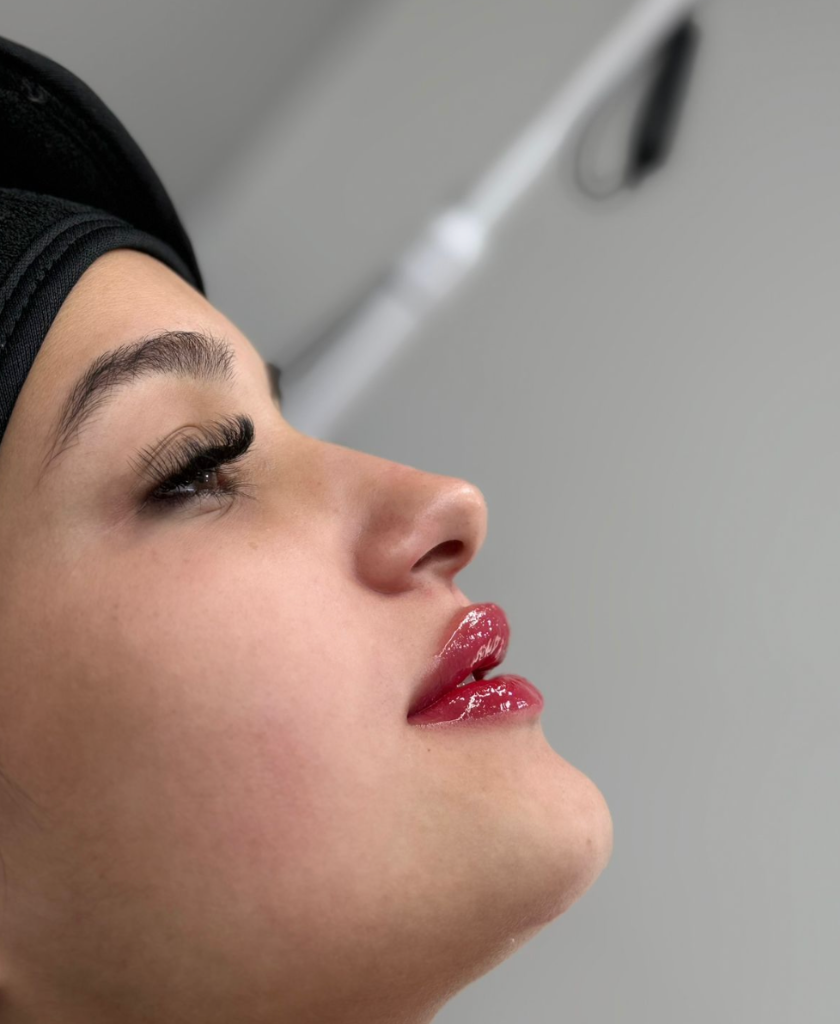 Resultado Real Lips Day